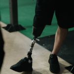 Artificial Limbs