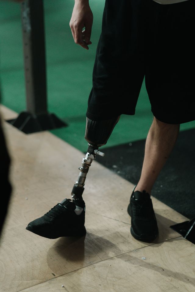 Artificial Limbs