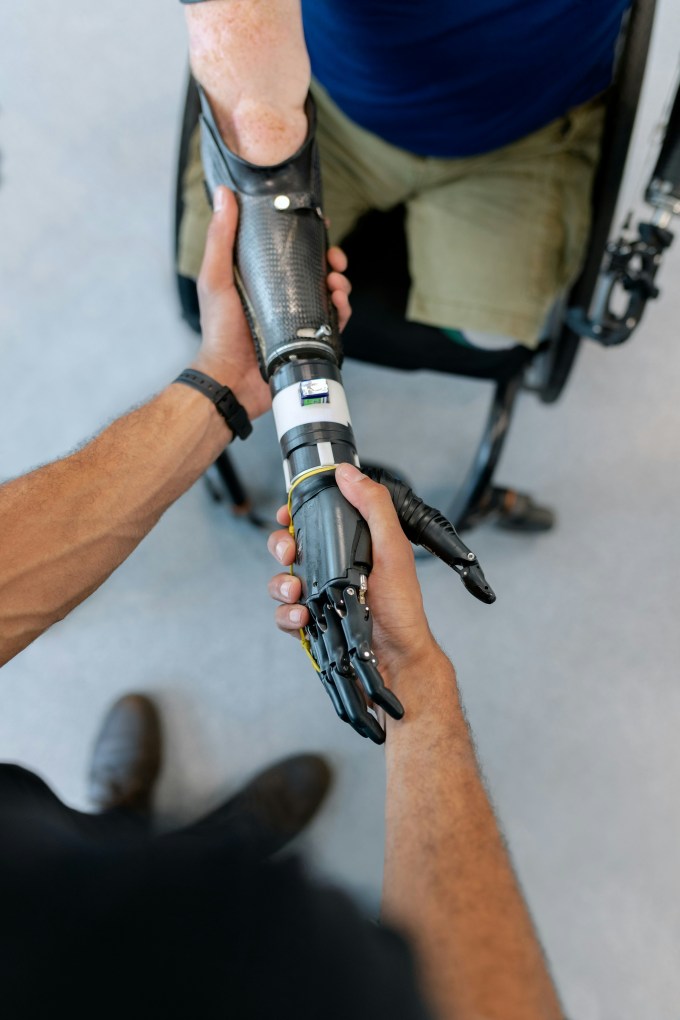 artificial limbs 2026